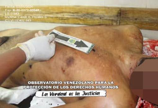 Disparos en el torso en uno de los cadáveres